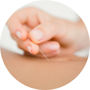 Akupunktur Rückenschmerzen Erfahrungen